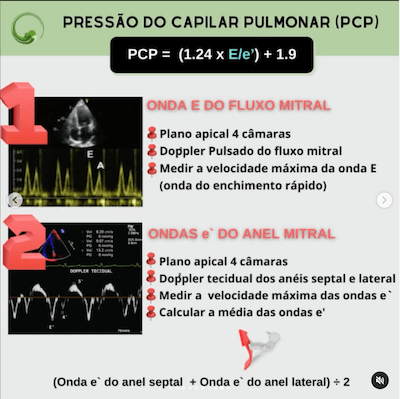 Pcp ecocardiograma como cateter swan ganz wavesmed