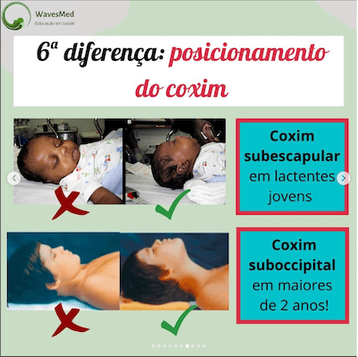 Posicionamento coxim intubação criança wavesmed