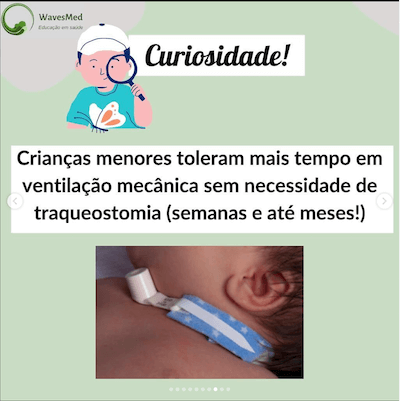 Curiosidade intubação criança wavesmed