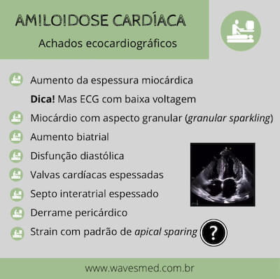 Achados ecocardiográficos amiloidose cardíaca wavesmed