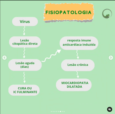 Fisiopatologia resumo diretriz miocardite wavesmed