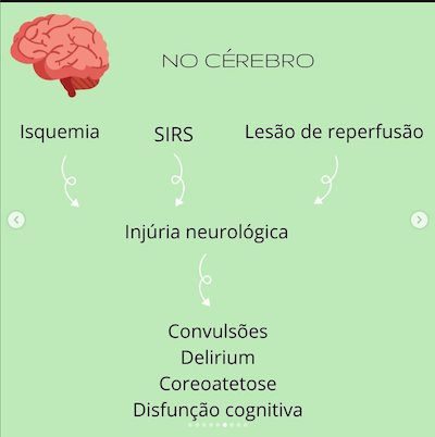 Consequências cérebro circulação extracorpórea cec na cardiopatia congênita wavesmed