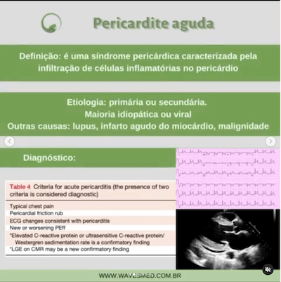 Pericardite aguda pericardite aguda derrame pericárdico Wavesmed