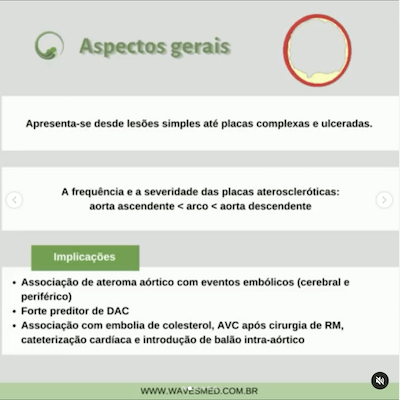 Aspectos gerais aterosclerose aorta Wavesmed