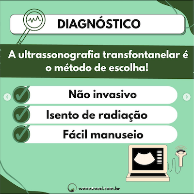 Diagnostico USG na hemorragia ventricular neonatal Wavesmed