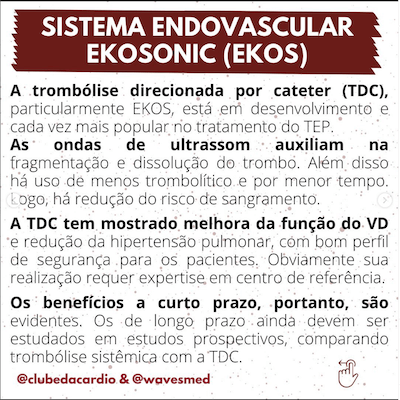 Endovascular TEP maciço trombólise Wavesmed