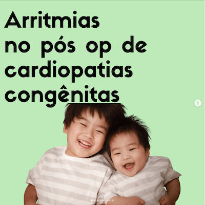 Arritmias pós operatório cardiopatias congênitas Wavesmed