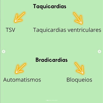 Taquicardias arritmias pós operatório cardiopatias congênitas Wavesmed