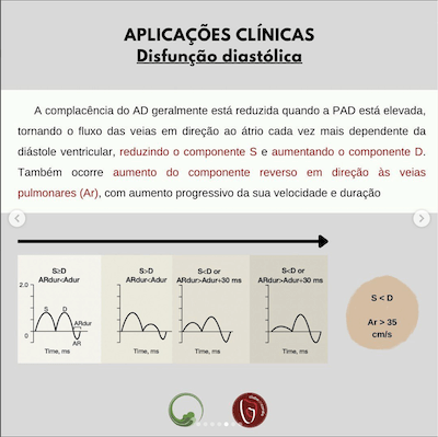 Disfunção diastólica avaliação veias pulmonares ecocardiograma Wavesmed