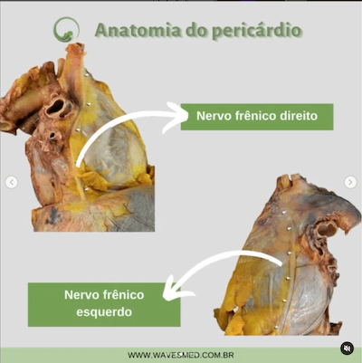 Nervo frênico anatomia pericárdio Wavesmed