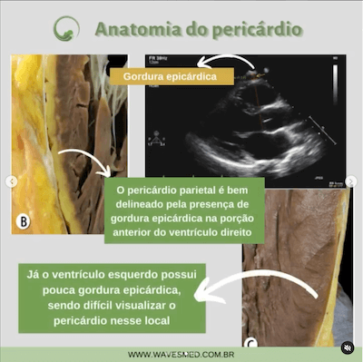 Pericárdio parietal anatomia pericárdio Wavesmed