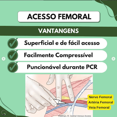 Acesso femoral complicações cateter venoso central Wavesmed