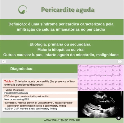 Pericardite aguda definição pericardite aguda derrame pericárdico Wavesmed