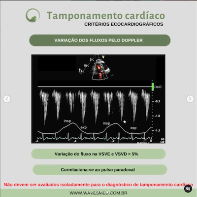 Fluxos tamponamento cardíaco Wavesmed