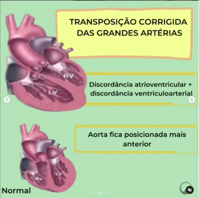 TCGA definição TCGA Wavesmed