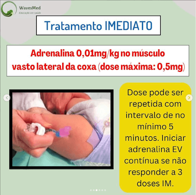 Tratamento como conduzir anafilaxia Wavesmed