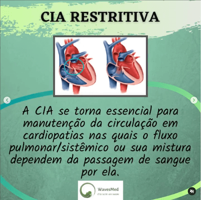 Definição- CIA restritiva ECO Wavesmed