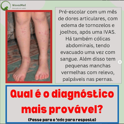 Vasculite por IgA Wavesmed