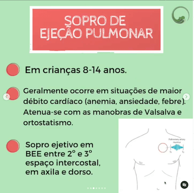 Sopro ejeção pulmonar sopro inocente Wavesmed