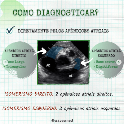 Diagnostico heterotaxias Wavesmed