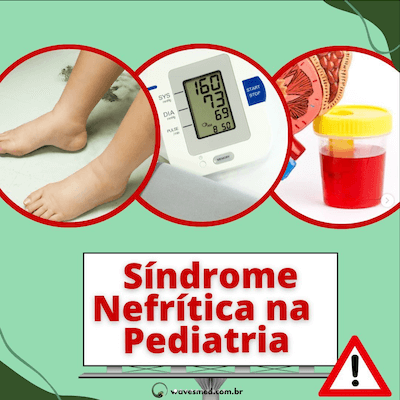 Síndrome nefrítica pediatria Wavesmed