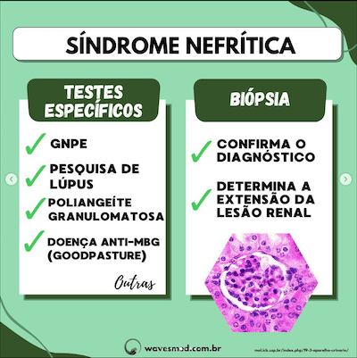 Biopsia síndrome nefrítica pediatria Wavesmed