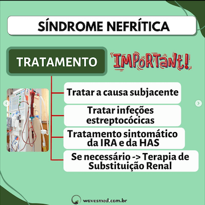 Tratamento síndrome nefrítica pediatria Wavesmed