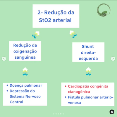 Redução sat arterial causas cianose recém nascido Wavesmed