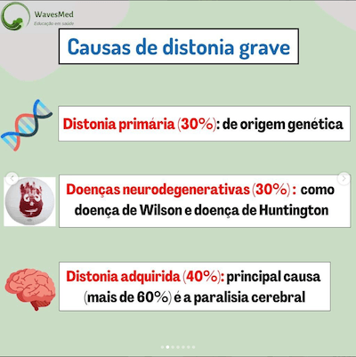 Causas distonia grave Wavesmed