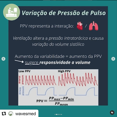 Variação pressão pulso responsividade volêmica Wavesmed