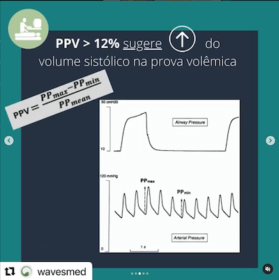 PPV responsividade volêmica Wavesmed