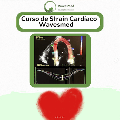 Curso Strain Cardiaco Wavesmed