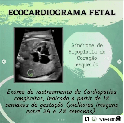 Definição eco fetal indicações Wavesmed