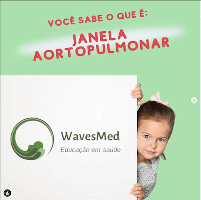 Janela aorto pulmonar Wavesmed