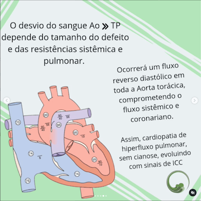 Fisiopatologia janela aorto pulmonar Wavesmed