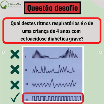 Cetoacidose diabética padrões respiratórios criança Wavesmed