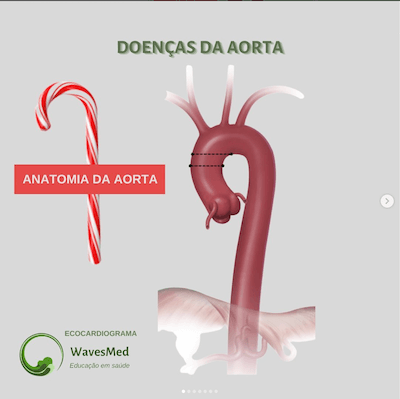 Anatomia aorta Wavesmed