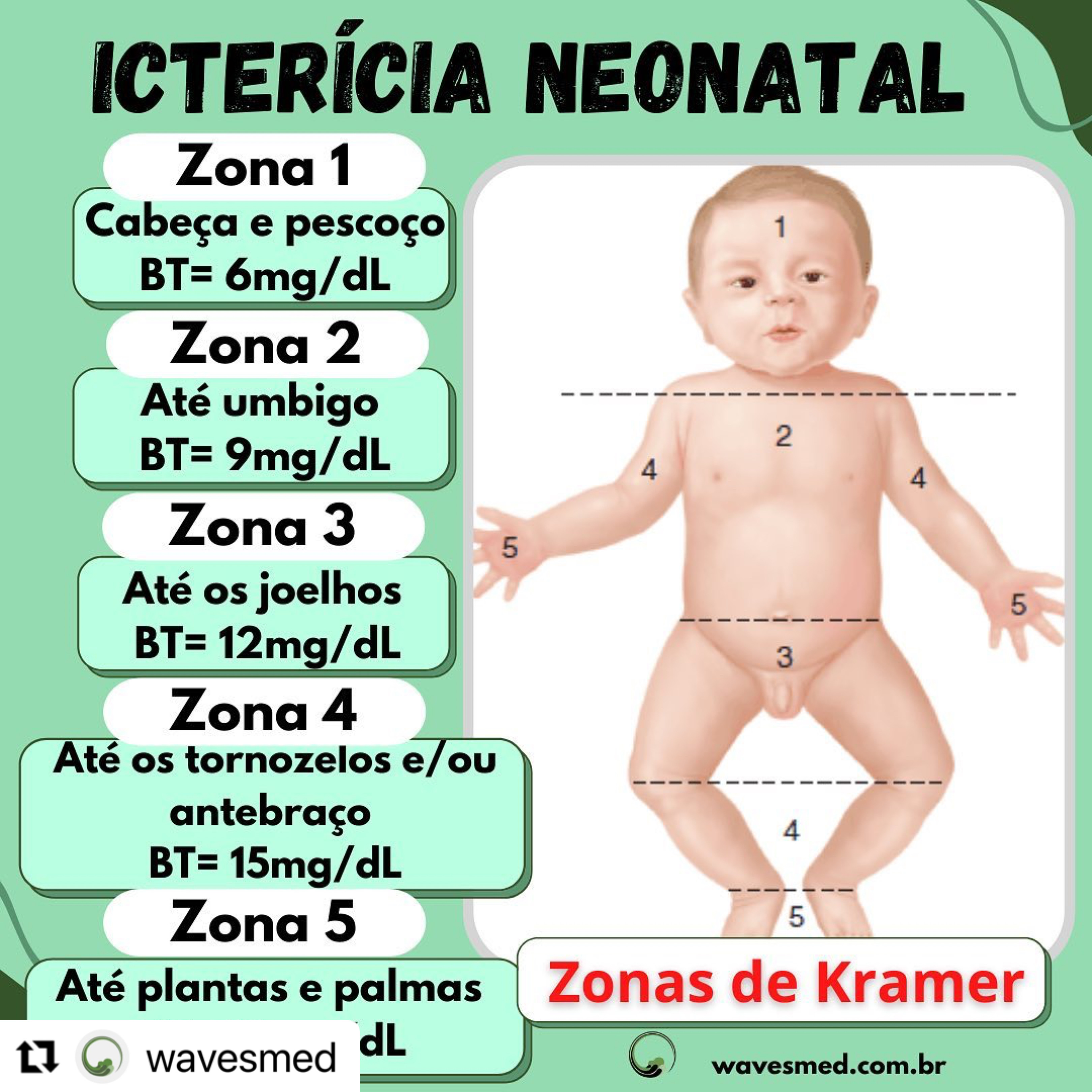 Icterícia Neonatal  ❓Por que os bebês ficam ictéricos?  wavesmed