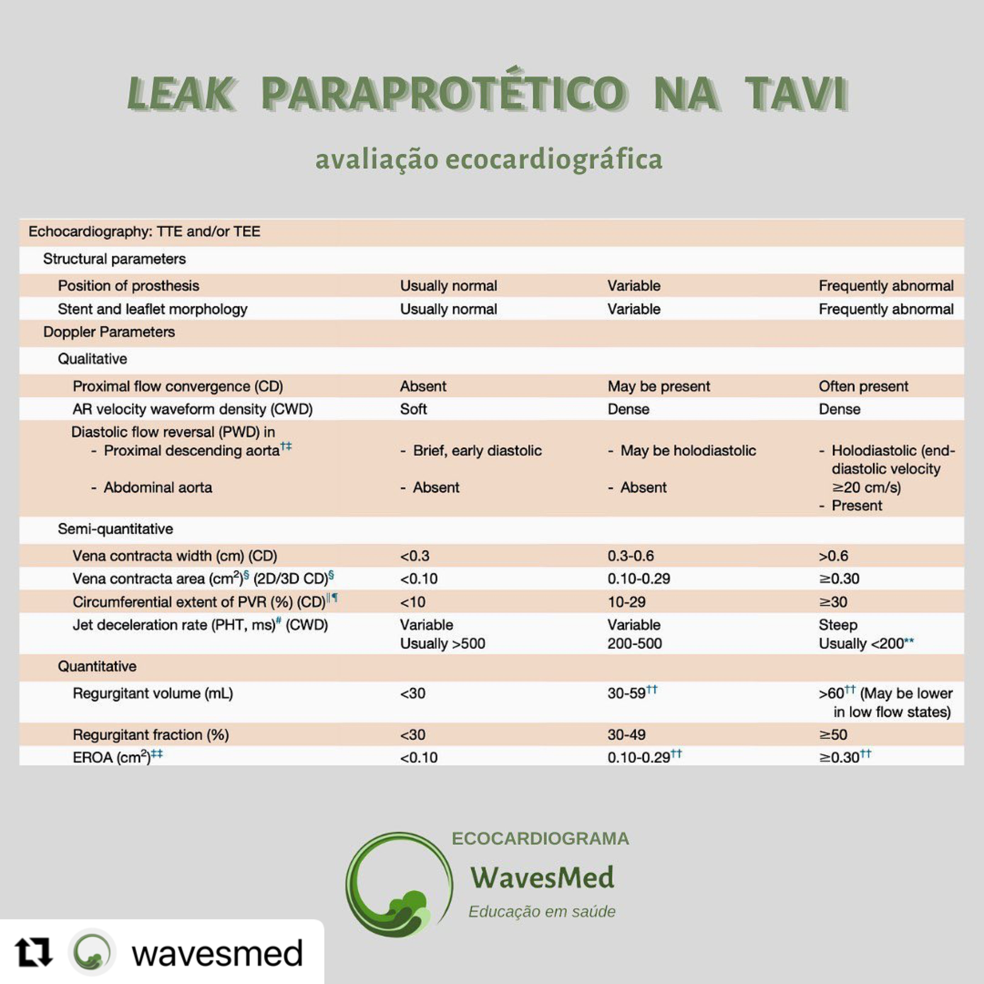 Leak paraprotetico na TAVI Wavesmed