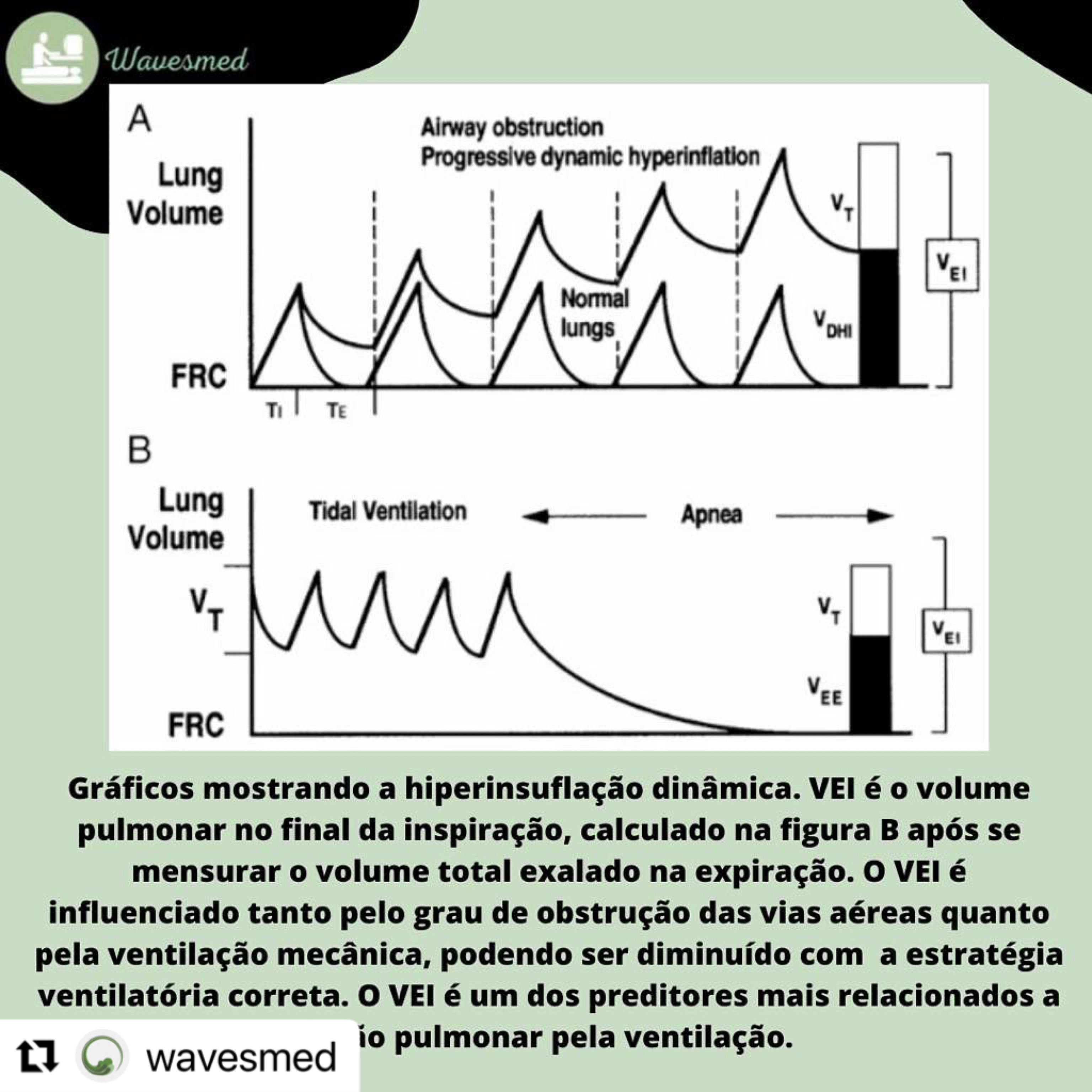 graficos de ventilação mecânica