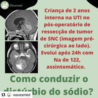 Caso clínico distúrbio de sódio na Uti Wavesmed