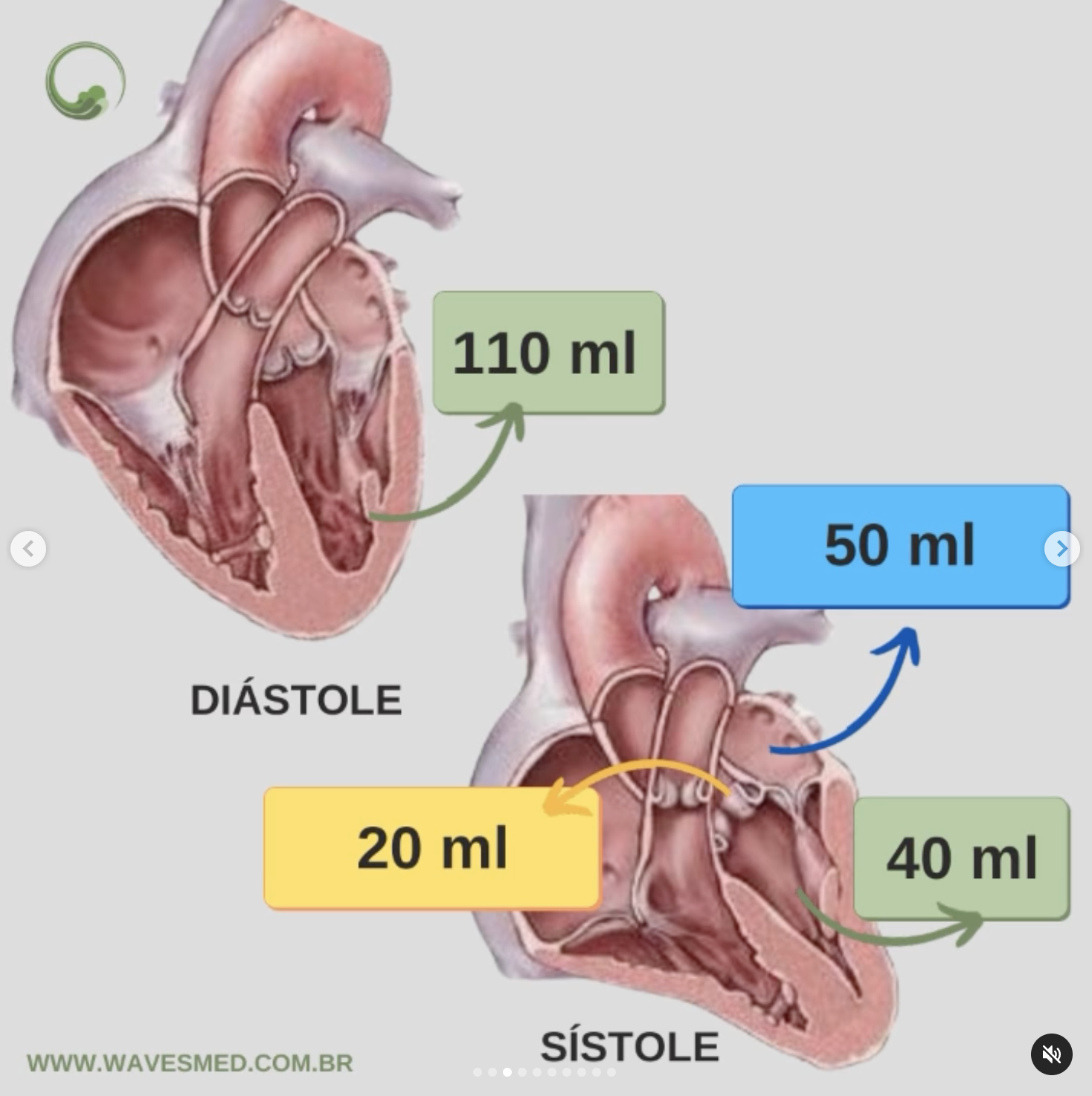 insuficiência mitral fisiopatologia wavesmed