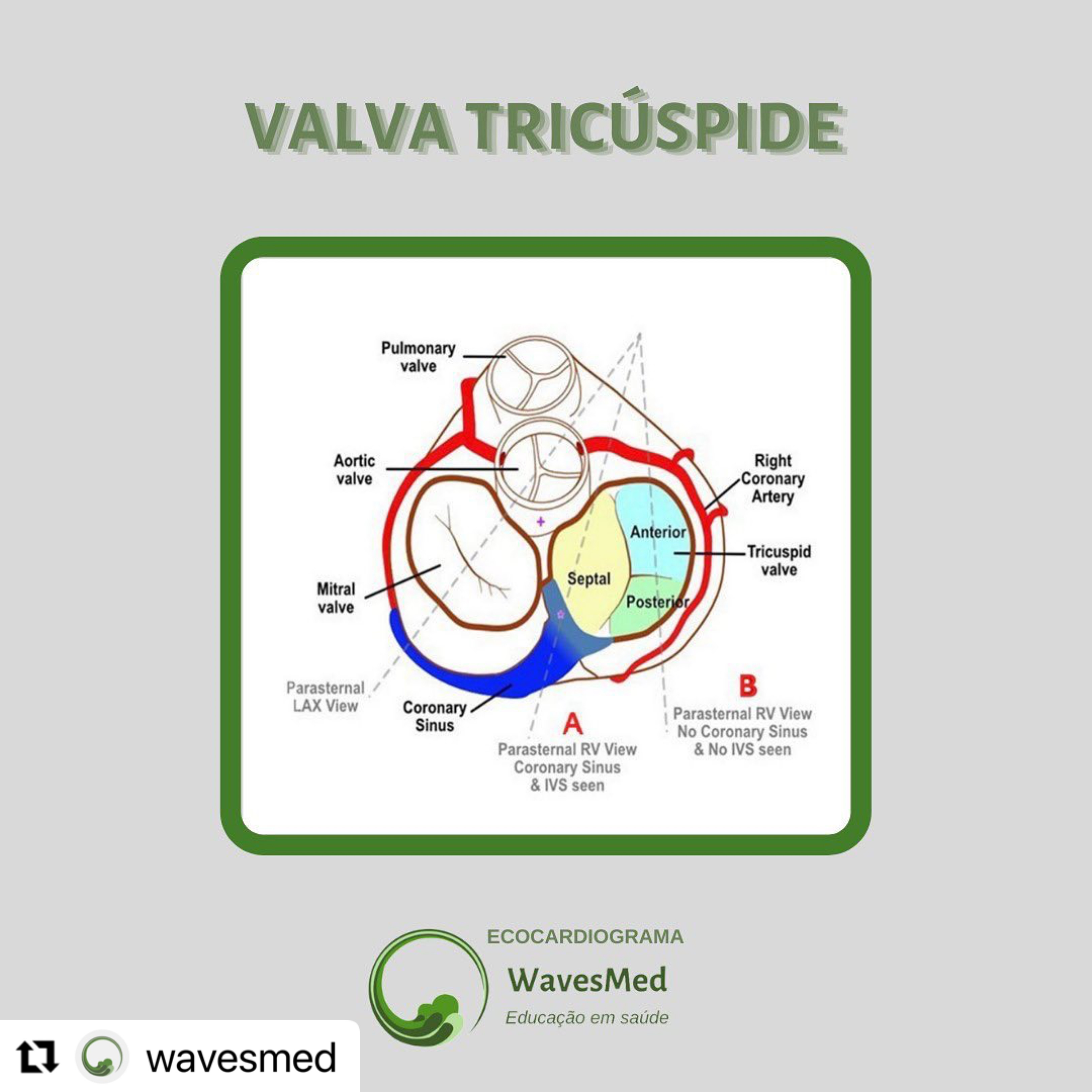 Anatomia da valva tricúspide Wavesmed