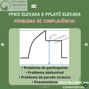 Complacência Ventilação mecânica Wavesmed