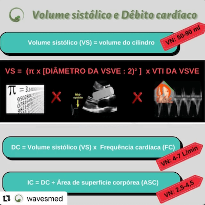 Volume sistólico e DC Wavesmed