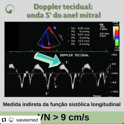 Doppler tecidual Wavesmed