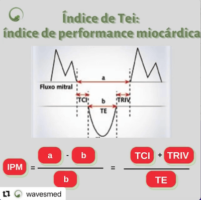 Índice de TEI (índice de performance miocárdica) Wavesmed