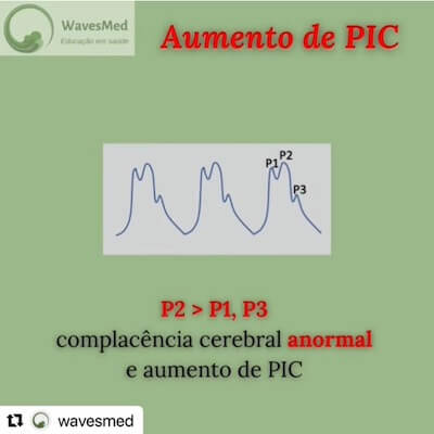 Aumento de Pressao intracraniana