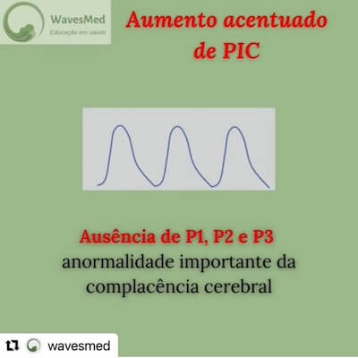 Aumento acentuado de pressao intracraniana