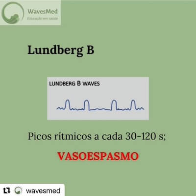 PIC Lundberg B Vasoespasmo